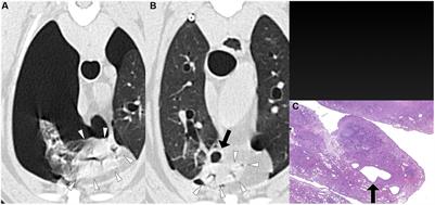 Improved detection of air-filled lesions using computed tomography in dogs with recurrent spontaneous pneumothorax through reduction of pulmonary atelectasis via positive pressure ventilation